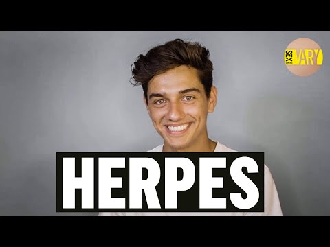 Video: Anal Herpes: Symptomer, Behandling, Diagnose Og Mere