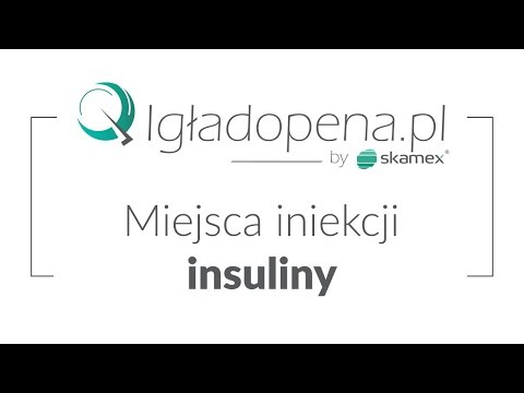 Wideo: Miejsca Wstrzyknięć Insuliny: Gdzie I Jak Wstrzykiwać