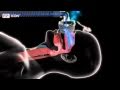 Fisher and Paykel ICON Series CPAP Machine - In Use Animation