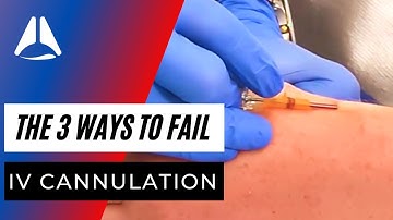 There are only 3 ways you can fail iv cannula insertion