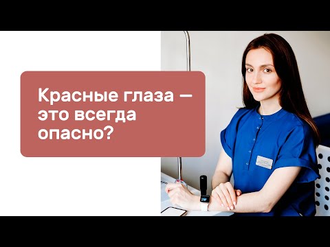 Красные глаза — это всегда опасно?