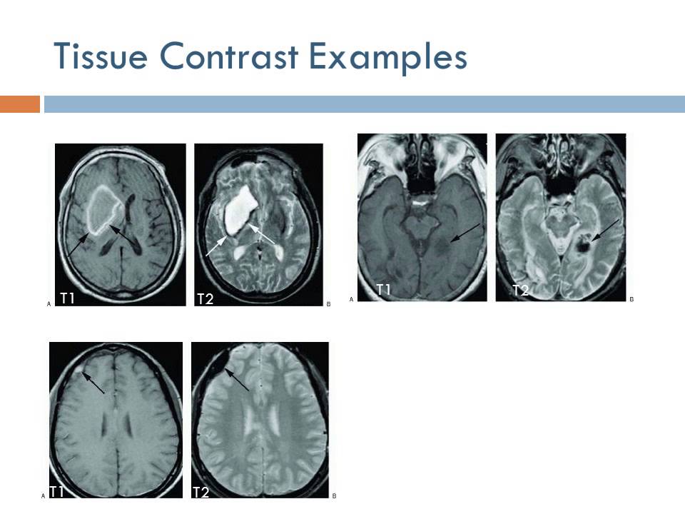 Medical Equipment Resonance Imaging (Arabic Narration) YouTube