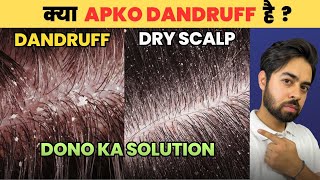 Say Goodbye to Dandruff or Dry Scalp *HONEST SOLUTIONS*