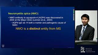 Optic Neuritis: It's not just multiple sclerosis anymore  John Chen, MD, PhD
