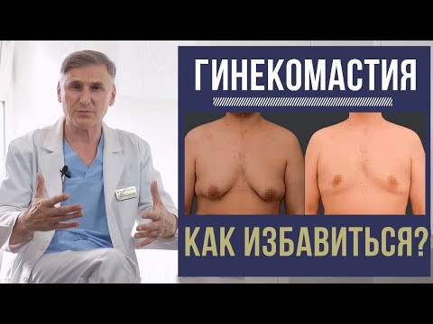 ГИНЕКОМАСТИЯ: КАК ИЗБАВИТЬСЯ? 🆘 ОСЛОЖНЕНИЯ