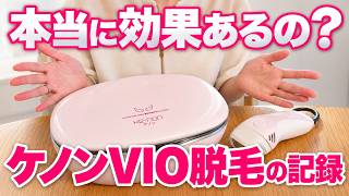 ミュゼ家庭用脱毛器使用レビュー｜スキンケアモードで