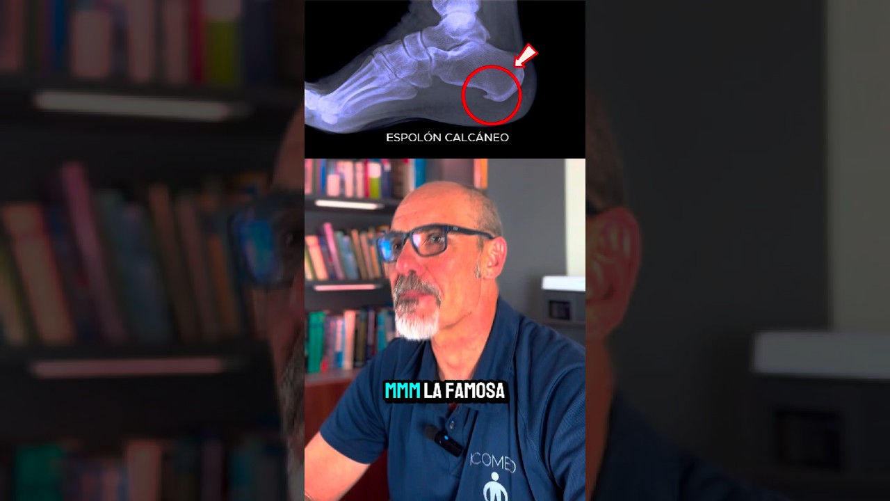 ❌ ¿Las plantillas curan la fascitis plantar y el espolón? 👉 La verdad que nadie te cuenta #fascitis