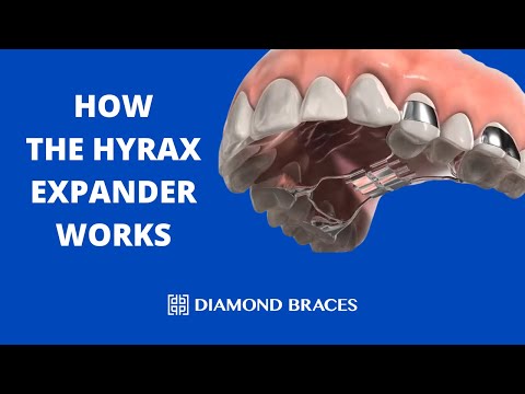 Hyrax Expander