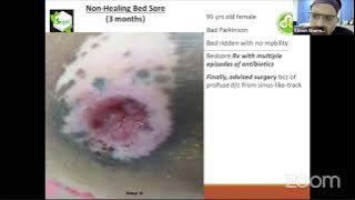 Product in demand by Clinicians : Sepil India