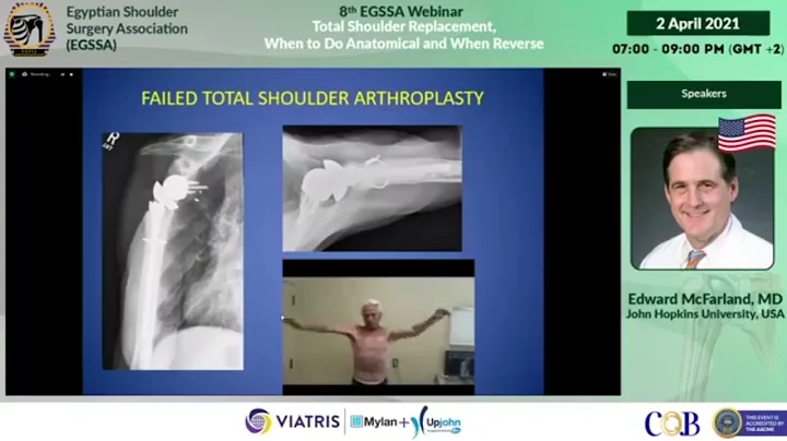 Outcomes after shoulder replacement   Comparison b...