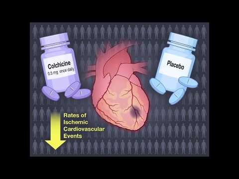 Video: Zeitliche Trends Bei Der Ressourcennutzung Und Den Kosten Im Gesundheitswesen Nach Akutem Myokardinfarkt