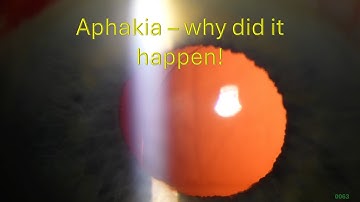 0063: Aphakia - waarom is dit gebeurd?
