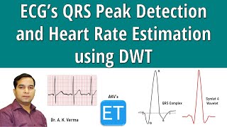 ECG QRS Peak Detection and Heart Rate Estimation using DWT