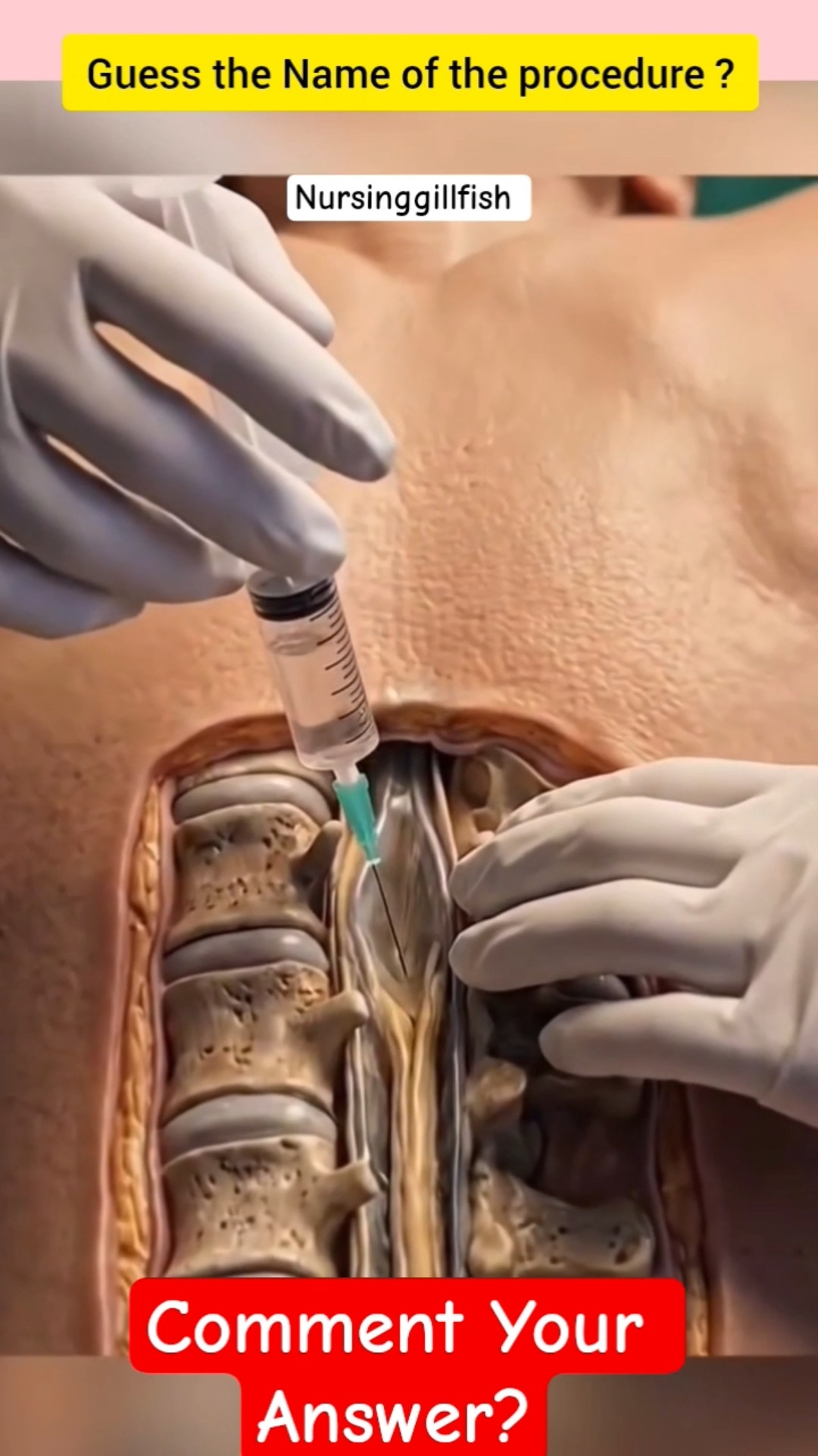 ⚡ஷேர்சாட் அப்டேட் - ShareChat