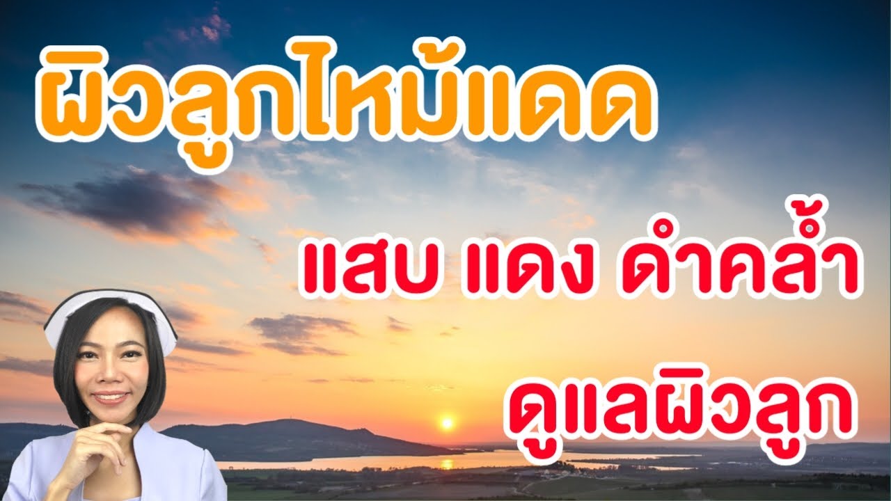 ผิวลูกไหม้แดด แสบ แดง ดำคล้ำ ดูแลผิวลูกแบบนี้