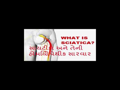 સાયટીકા અને તેની હોમિયોપેથીક સારવાર !!Sciatica and its homeopathic treatment