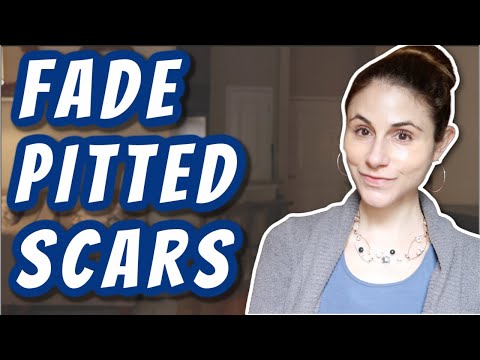 How to FADE PITTED SCARS | Dr Dray