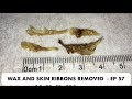 LONG SKIN RIBBONS AND EAR WAX REMOVAL  - EP 57