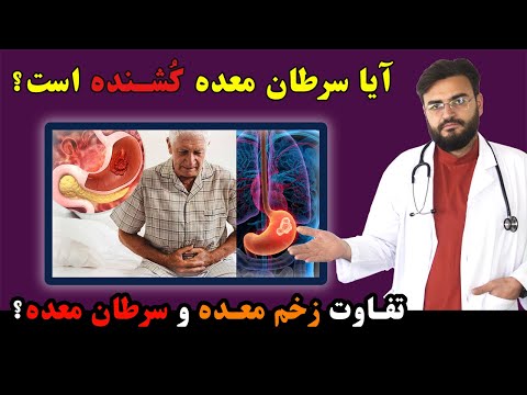 تصویری: آیا سرطان مری همیشه کشنده است؟