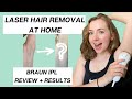 LASER HAIR REMOVAL AT HOME? IPL Review & Results (12+ Weeks) (Braun Silk Expert 5)