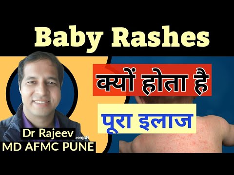 Skin Rash in baby skin treatment Hindi | Dr Rajeev - YouTube