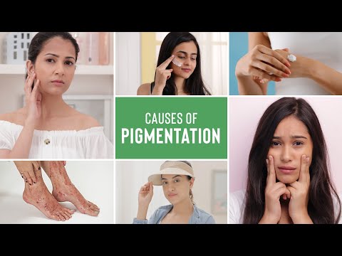 What Is Pigmentation On Face & What Are The Causes Of Pigmentation | Cosmetologist Explains