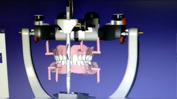 Exocad digital denture with digital mounting