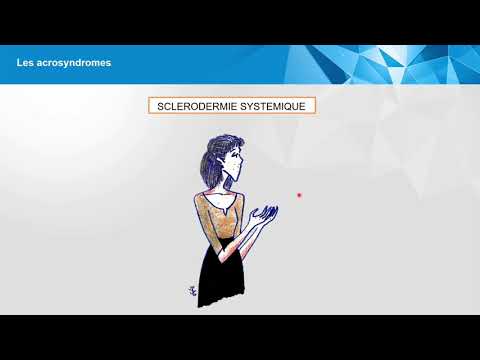 Vidéo: Cancer De La Peau (lymphome épidermotrope) Chez Le Chien