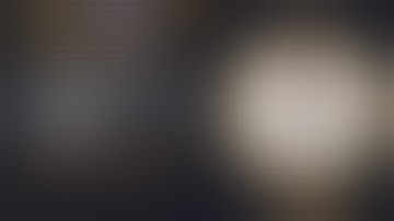 Wiroc Global 2022 : Posterior tibial plateau fractures - Tips & Tricks - Rodrigo Pesantez