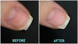 How To Fix Broken Nail With Polygel | Very Easy | Step By Step Tutorial