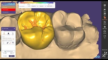 Aidite Exocad design guide: Single crown of prosterior teeth and Software introduced