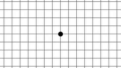 Amsler Grid