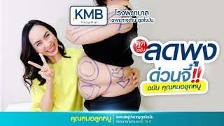 ดูดไขมันดีกว่า ลดแบบอื่นยังไง ?? คุณหมอลูกหนูมาไขข้อสงสัยให้ค่ะ KMB hospital โรงพยาบาลดูดไขมัน