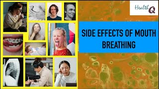 SIDE EFFECTS OF MOUTH BREATHING