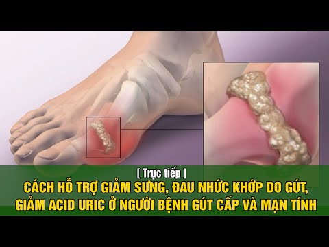 Video: 3 cách để giảm đau do gút ở ngón tay của bạn