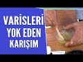 Varisleri yok eden karışımın tarifi ve yapılışı...