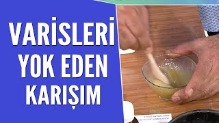 Varisleri Yok Eden Karışımın Tarifi Ve Yapılışı