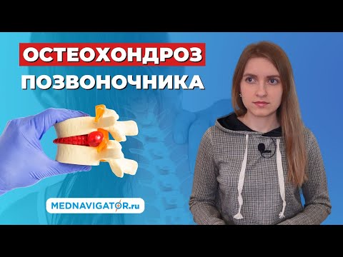 Шейный, грудной и поясничный ОСТЕОХОНДРОЗ - симптомы, причины, стадии, диагностика | Mednavigator.ru