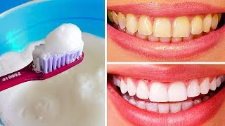 10 Natural Ways to Whiten Teeth at Home screenshot 2