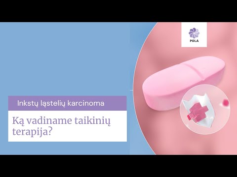 Video: Kas yra Jungo terapija?