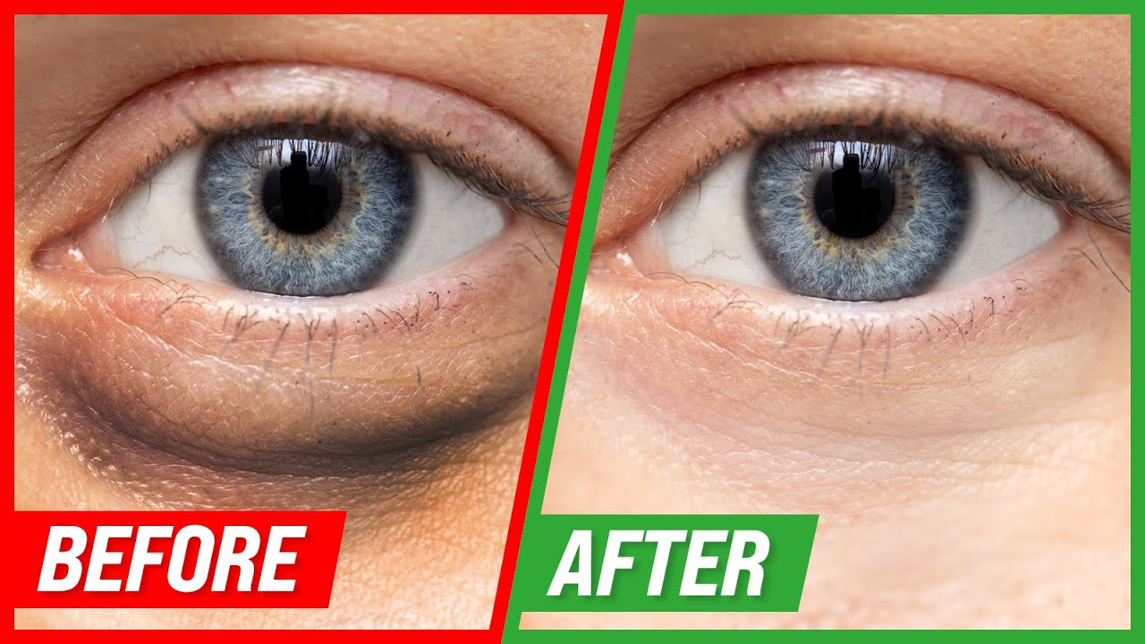 Stryx  How to Get Rid of Puffy Eyes & Why You Wake Up With Them