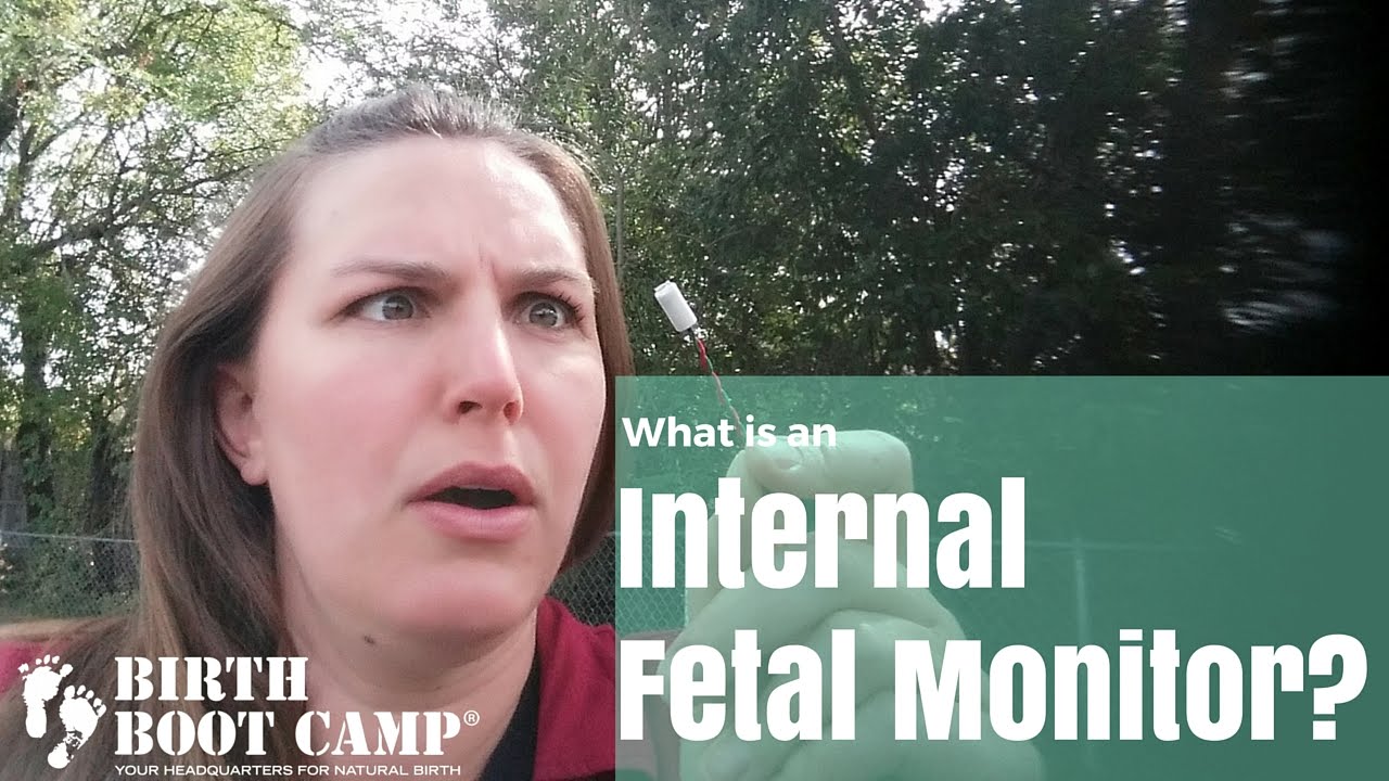 What is an internal fetal monitor? - YouTube