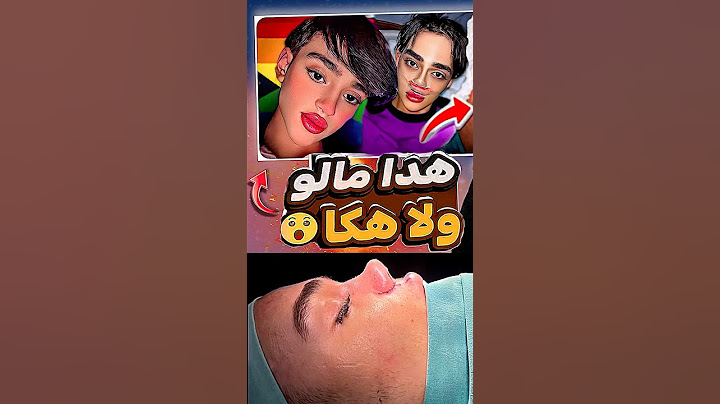 أش هاد لعجب هذا مالو ولا هاكا داير ياربي سلامة 😨😱 #explore #shortvideo #youtubeshorts #اكسبلور