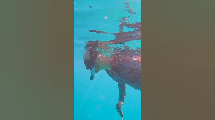 Jellyfish stung me on the face! - DayDayNews