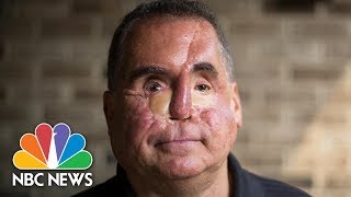 Journey Of A Bullet: Shot By Suspect | NBC News
