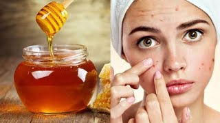 فوائد العسل للبشرة وصفاتين من العسل لازم كل البنات تعرفهم