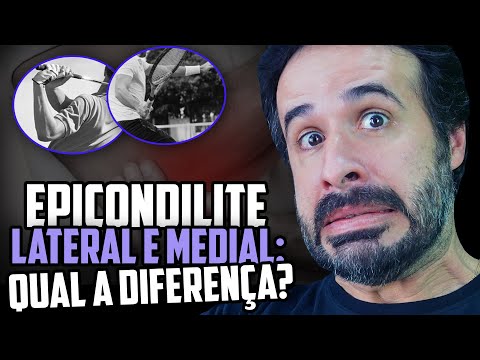 Vídeo: Diferença Entre Côndilo E Epicôndilo