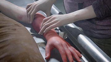 THE LAST OF US PART II REMASTERED IN CHRONOLOGICAL (SURVIVOR LEVEL NO DAMAGE!) COMPARTMENT SYNDROME