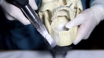 Orthopromed Micro System