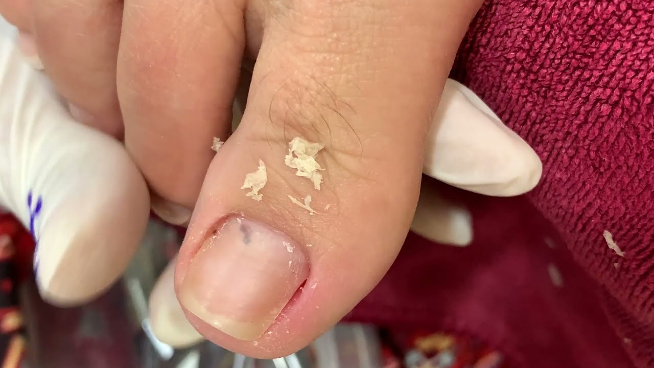 How to Repair Nails easy 333 YouTube